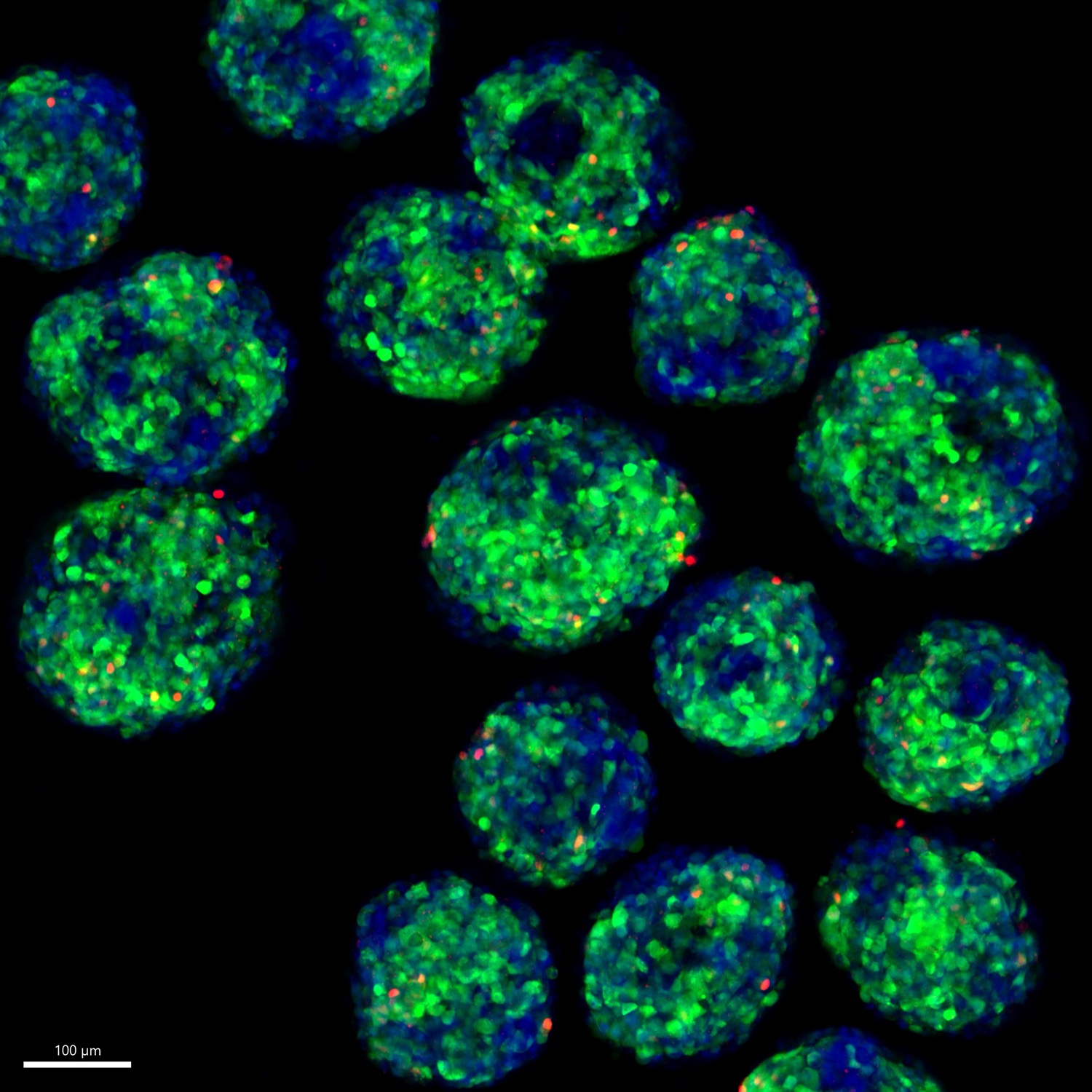 20220616_IAPP mScarC4ppRem_D21?timestamp=6800